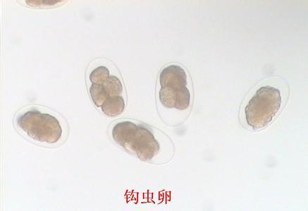 钩虫卵